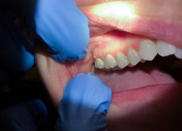 Best Pediatric Emergency Dentist in Advance, MO